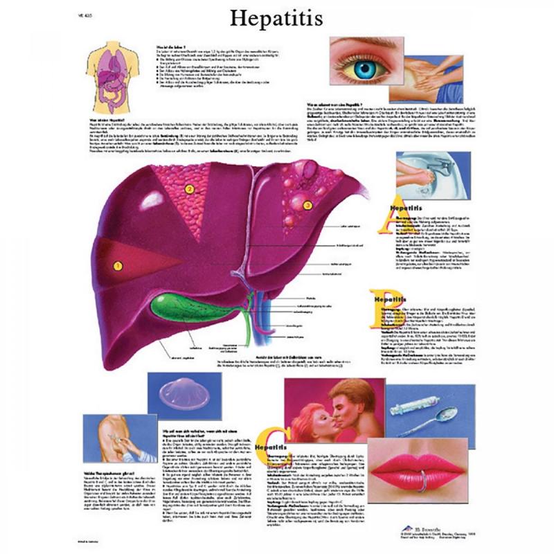All Products - Wandkaart: Hepatitis