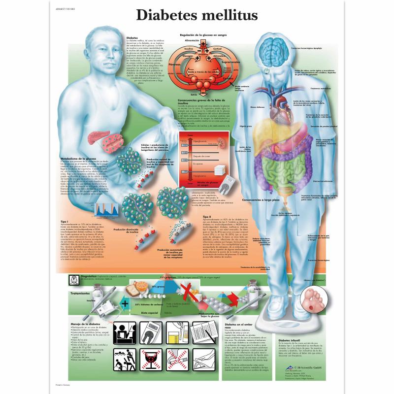 Wandkaart: Diabetes Mellitus