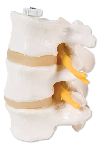 Wervelschijf Driedelig