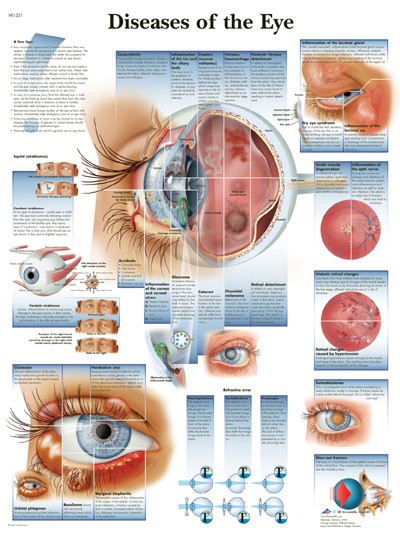 All Products - Wandkaart: Diseases Of The Eye