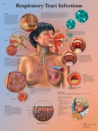 All Products - Wandkaart: Respiratory Tract Infections